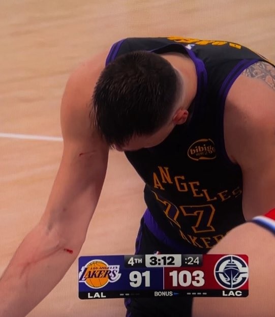 开云体育app-谁抓的~东契奇罚球时看向手臂 好几道伤口&amp;血迹斑斑